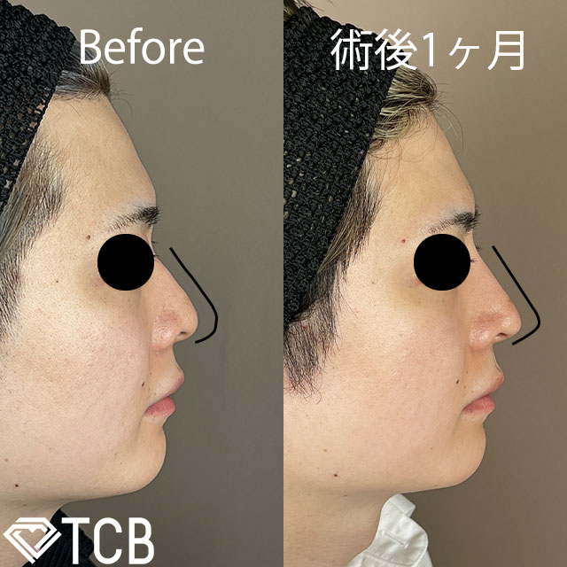 TCBメッシュ(担当医:TCB 医師)の症例写真1