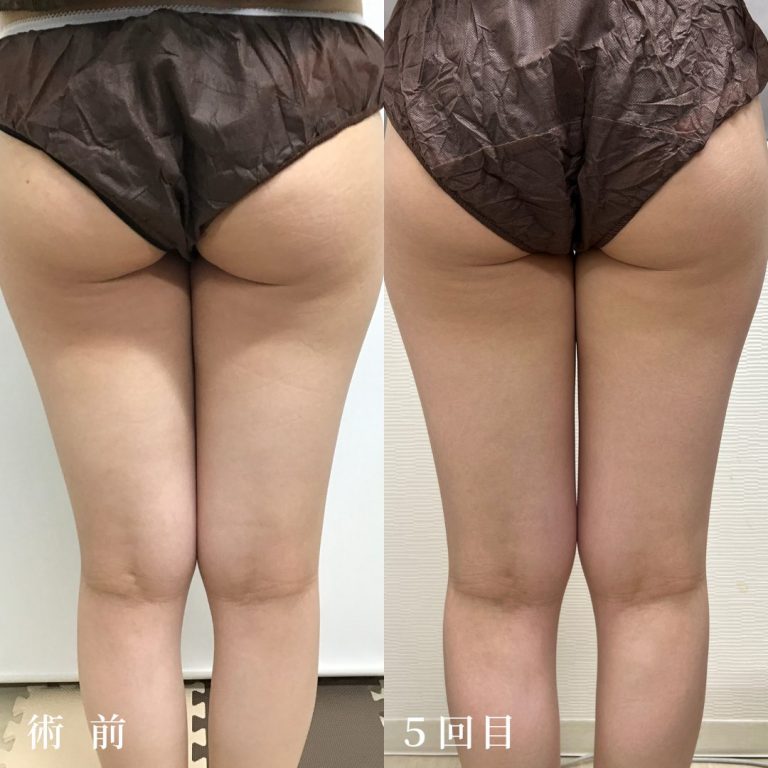 Dr.'sダイエット【医療全身ダイエット】(担当医:真鍋 秀明 医師)の症例写真2