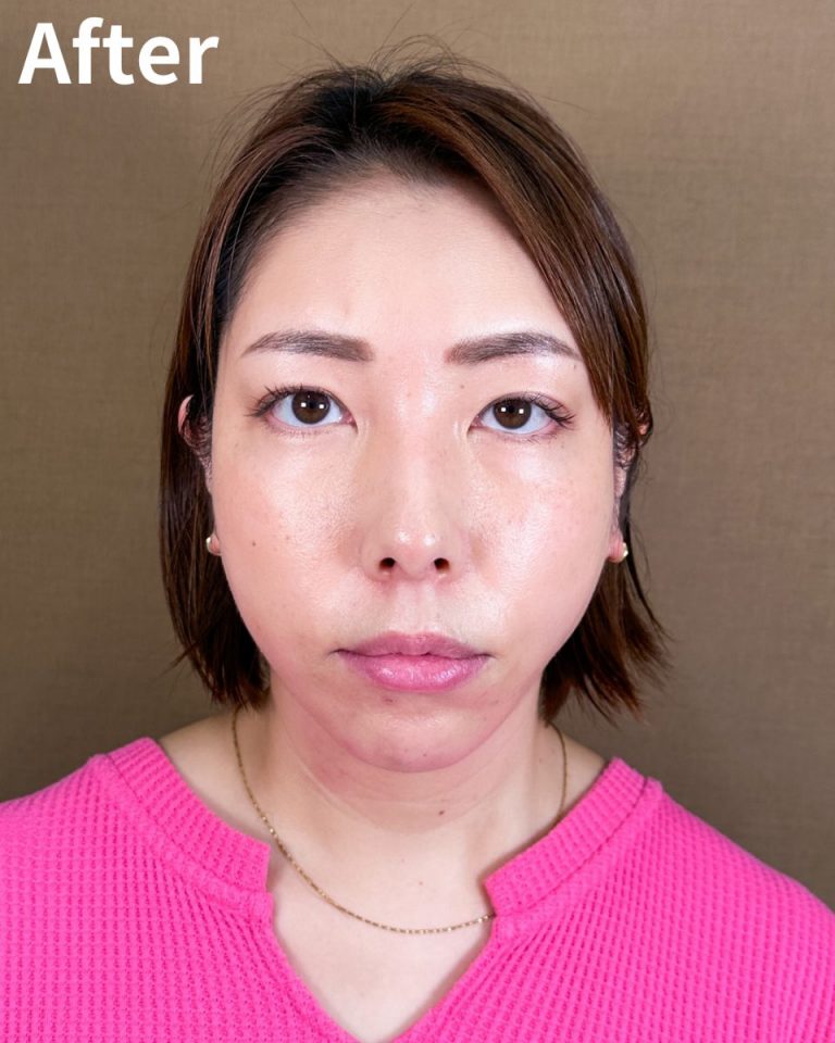 TCB式小顔美肌再生(担当医:岡本 卓也 医師)の症例写真3