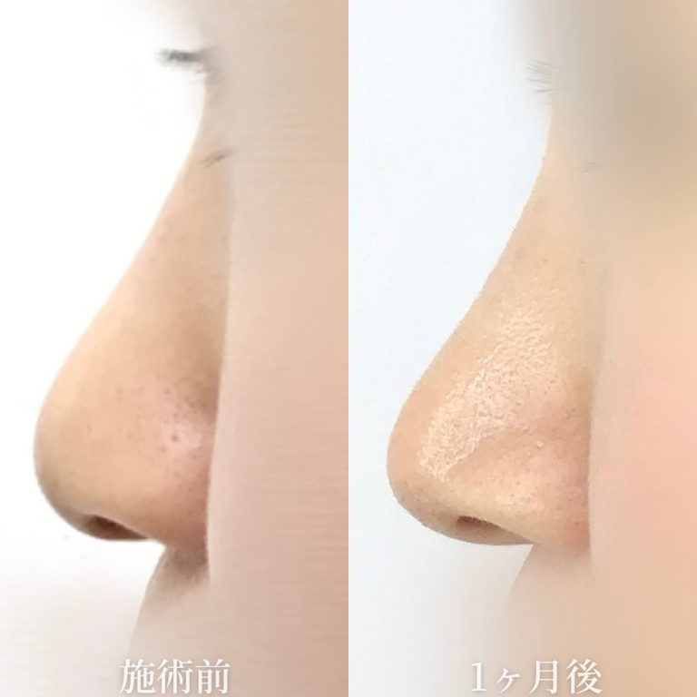 TCBメッシュ(担当医:垣花 瑠美子 医師)の症例写真2