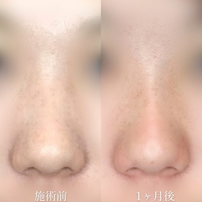 TCBメッシュ(担当医:垣花 瑠美子 医師)の症例写真1